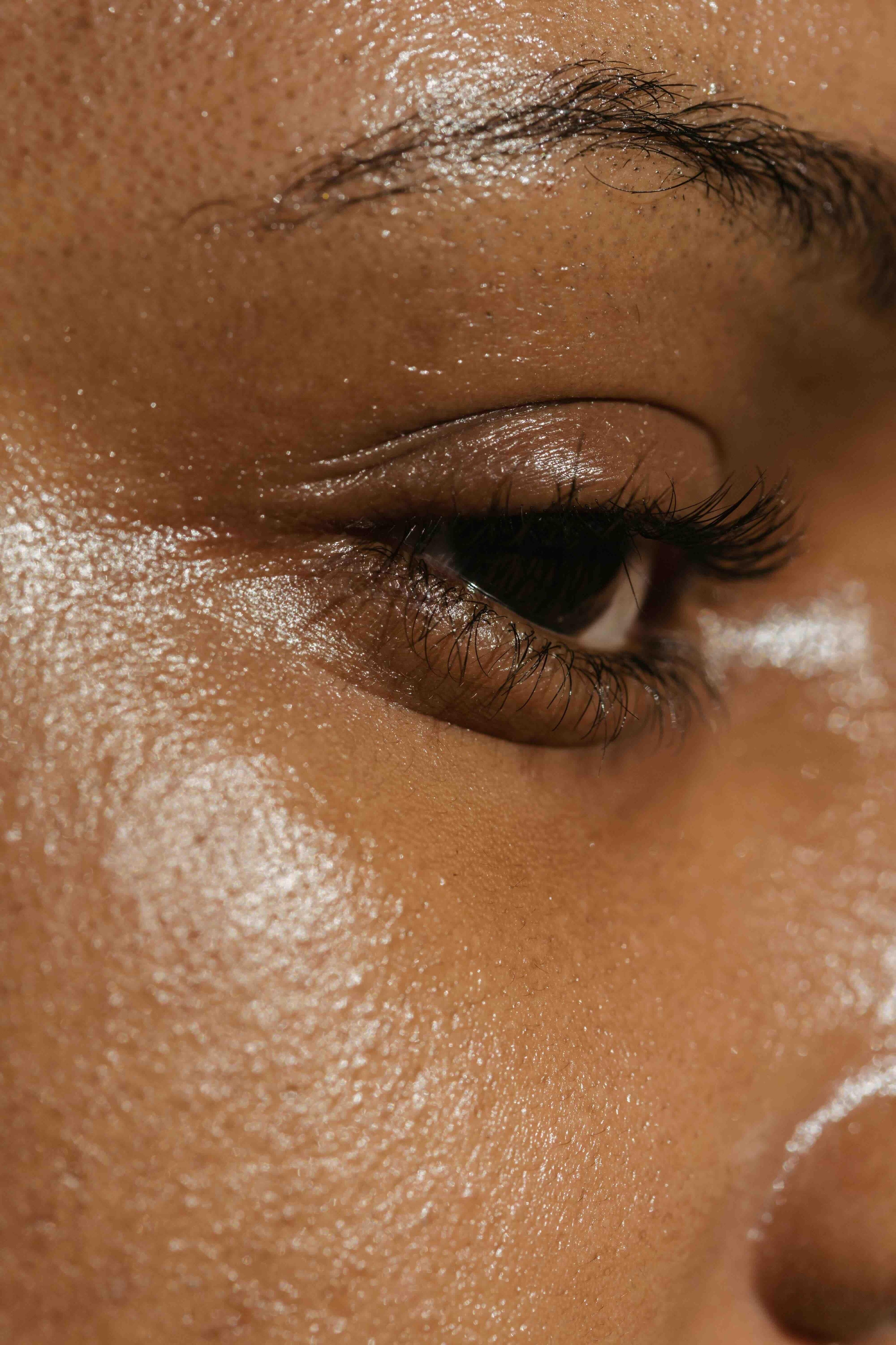 Woman's right side face with greasy skin